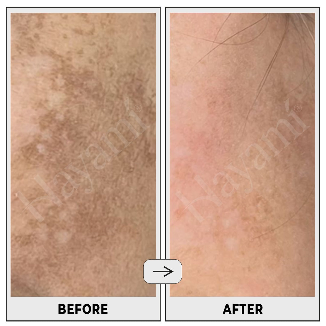 Brightening Peptide Serum